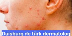Duisburg de türk dermatolog